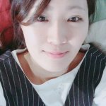 丸山桂里奈が目を整形した後