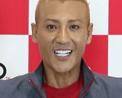 新庄剛志の整形後が変な顔に。。。