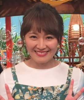丸山桂里奈の整形疑惑